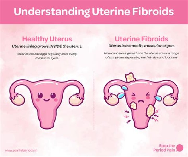 Kelly McCreary Urges Women Not To Ignore Fibroids After Revealing Painful Experience