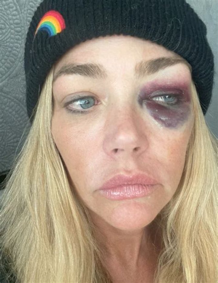 ‘RHOBH’: Lisa Rinna Calls Denise Richards A ‘Hypocrite’ As They Battle Over Her Risqué Behavior